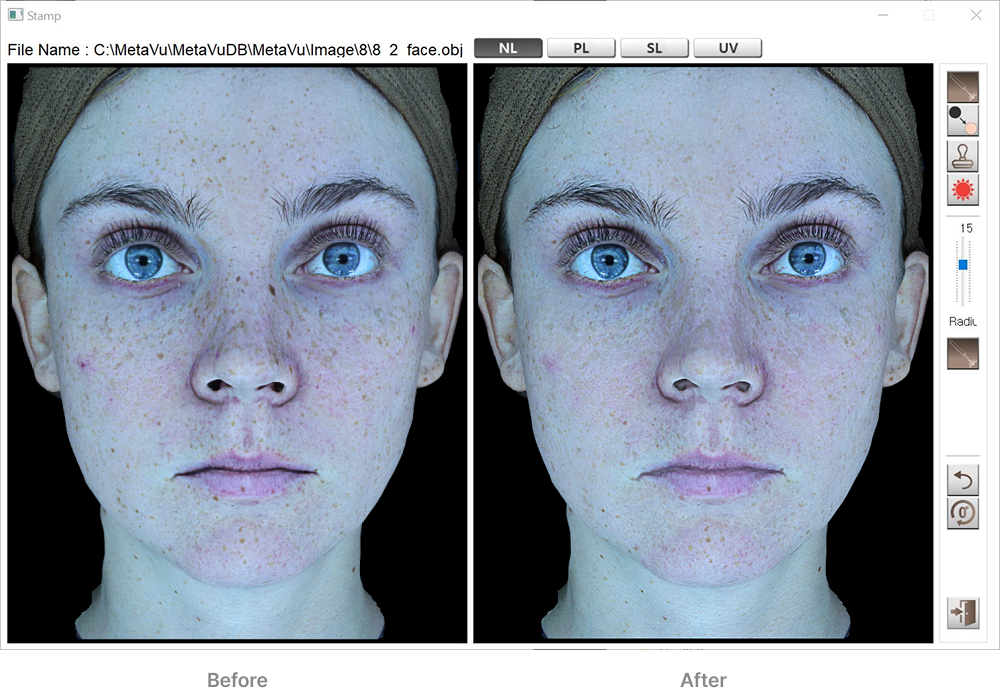 PL Before After