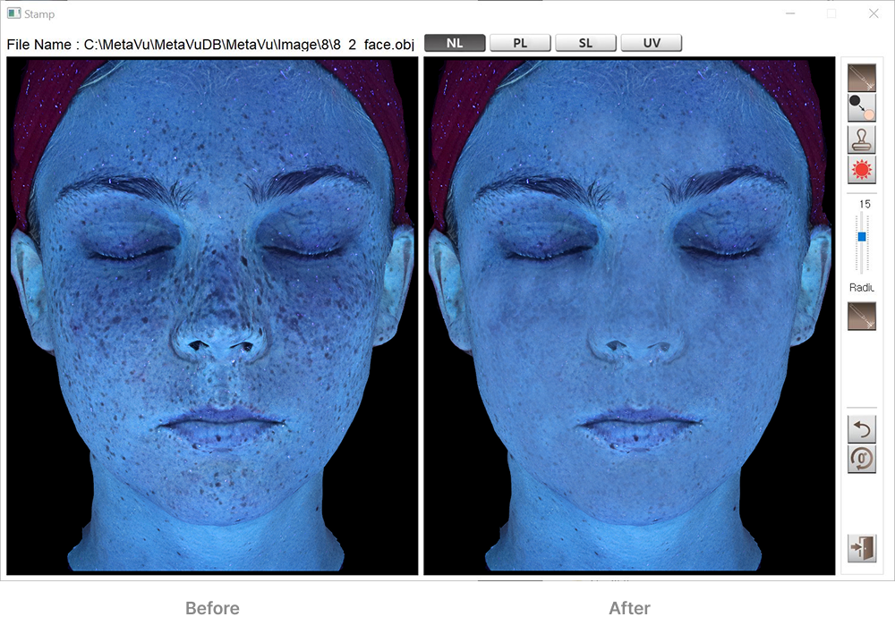 UV Before After